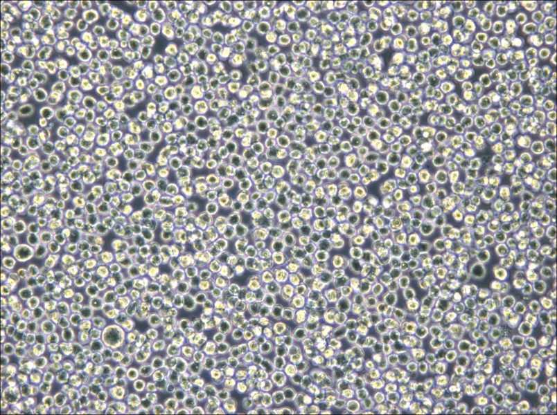 NB4 Cell Complete Medium - 4