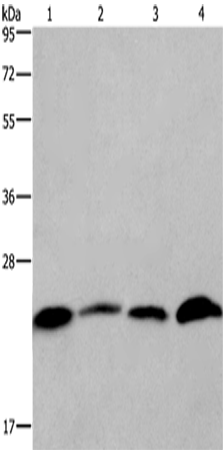 Western Blot analysis of Human placenta and testis tissue, Hela and Raji cell using CMTM6 Polyclonal Antibody at dilution of 1:700