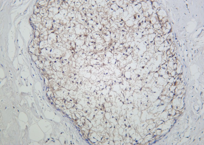 Recombinant GPX1 Monoclonal Antibody - small - 2