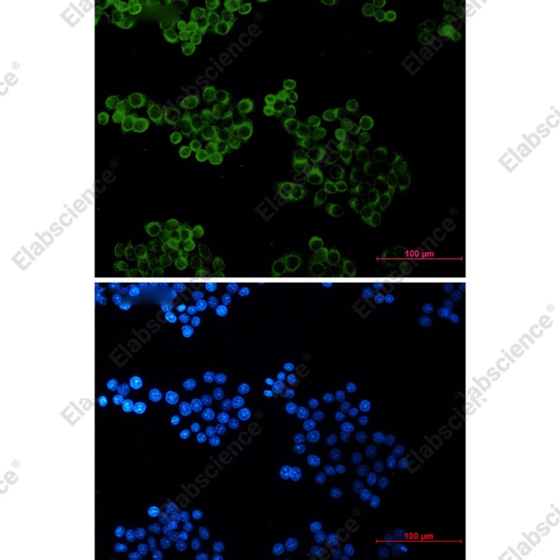 Recombinant BID Monoclonal Antibody - 3