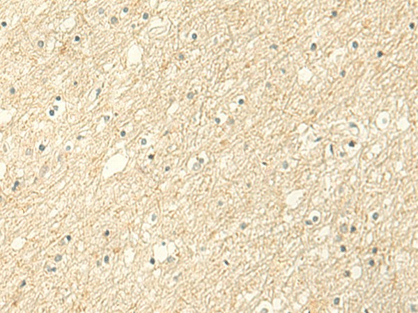 Immunohistochemistry of paraffin-embedded Human brain tissue  using ALPK1 Polyclonal Antibody at dilution of 1:50(?200)