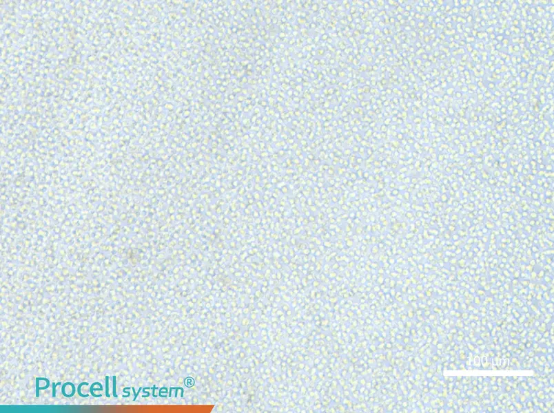 OCI-AML-2 - 1