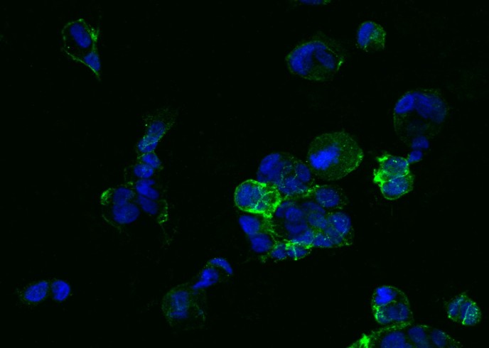 Recombinant TROP2/TACSTD2 Monoclonal Antibody - small - 2