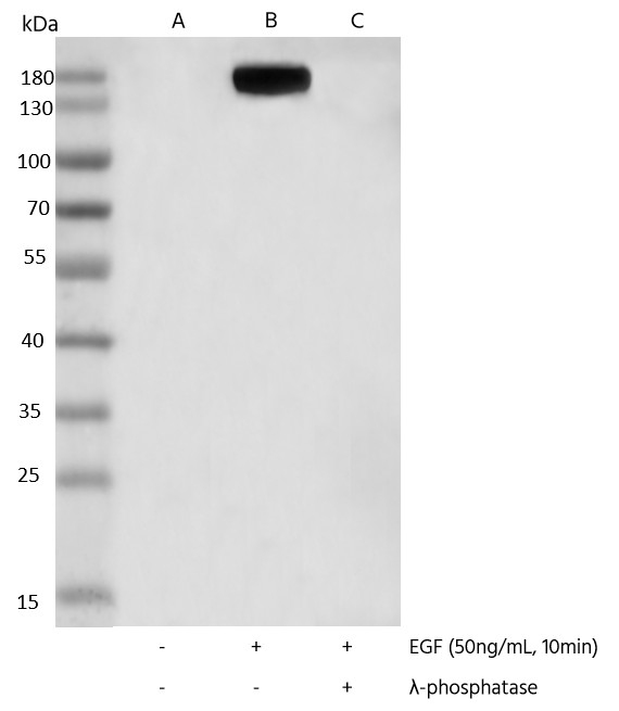 Recombinant Phospho-PLCγ1 (Tyr783) Monoclonal Antibody - small - 3
