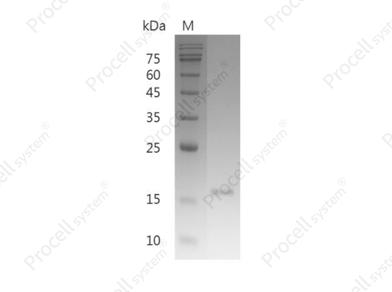 RANKL/TNFSF11/TRANCE/CD254, Mouse, Recombinant