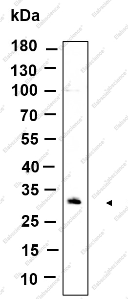 Recombinant CDIN1 Monoclonal Antibody - 1