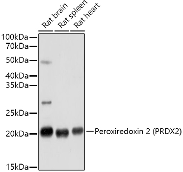 Western blot analysis of extracts of various cell lines using Peroxiredoxin 2 Polyclonal Antibody at 1:1000 dilution.