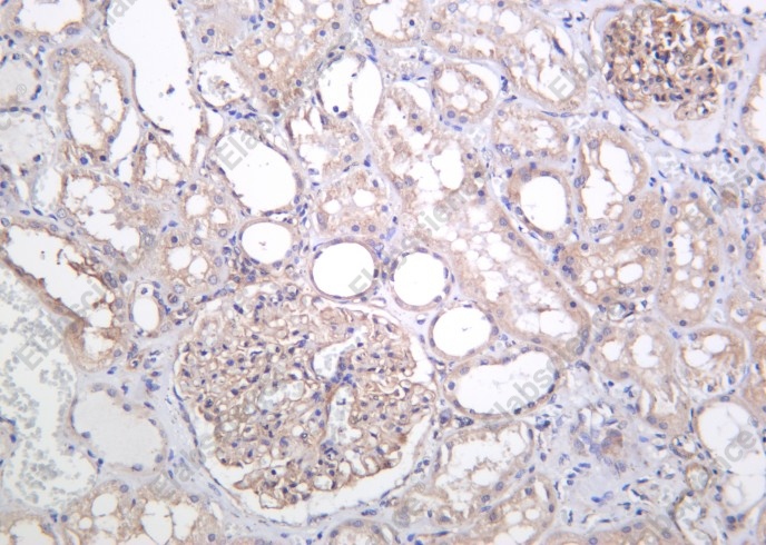 Recombinant TXNIP Monoclonal Antibody - 2