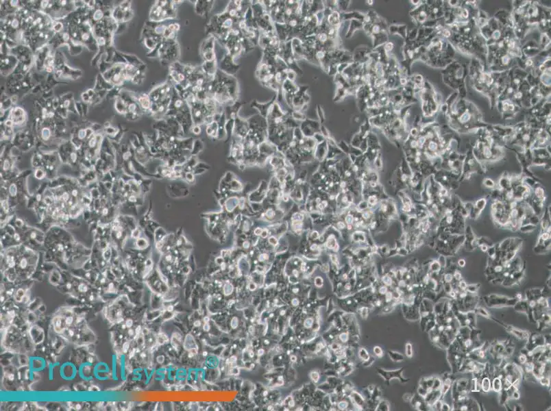 OE19 Cell Complete Medium - 3