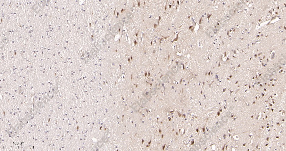 Recombinant TBR1 Monoclonal Antibody - 2