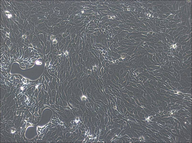 NCI-H2444 Cell Complete MediumNCI-H2444 Cell Complete Medium - 2