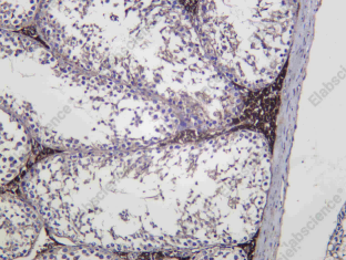 Recombinant FDX1 Monoclonal Antibody - 2