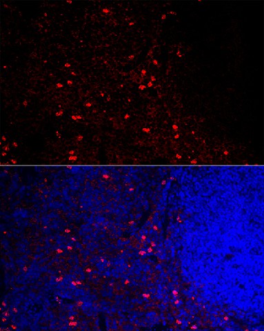 Immunofluorescence analysis of mouse spleen cells using CCR5 Polyclonal Antibody at dilution of 1:100 (40x lens). Blue: DAPI for nuclear staining.