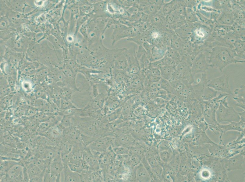 HCC38 Cell Complete Medium - 4
