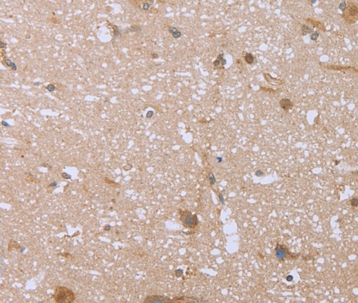 Immunohistochemistry of paraffin-embedded Human brain  using FHL2 Polyclonal Antibody at dilution of 1:40