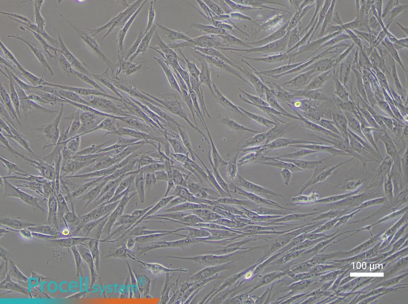 Human Uterine Fibroids Tissue-Derived Cell Complete Medium - 3