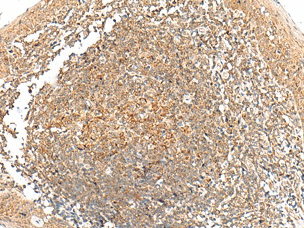 Immunohistochemistry of paraffin-embedded Human tonsil tissue  using GRHPR Polyclonal Antibody at dilution of 1:35(?200)