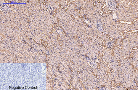 Immunohistochemistry of paraffin-embedded Rat kidney tissue using CD5 Monoclonal Antibody at dilution of 1:200.