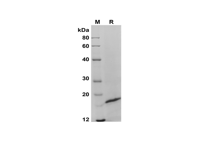 Recombinant Human PD-L1 Protein(His Tag)-产品推荐-1