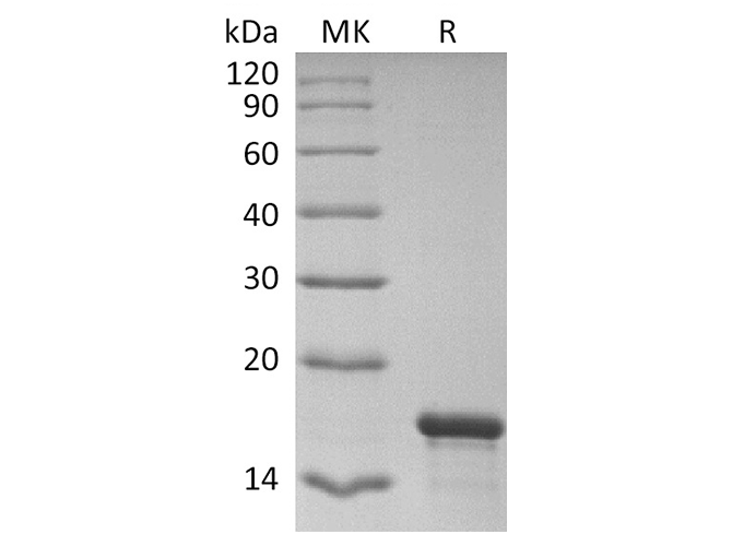 Recombinant 2019-nCoV NP NTD domain (His Tag)