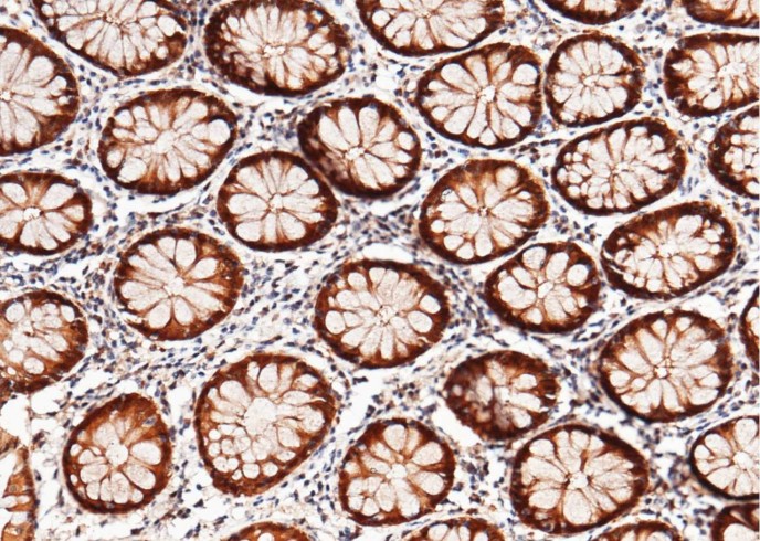 Recombinant Thioredoxin/TXN Monoclonal Antibody-searchlist-1