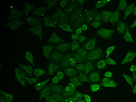 Immunofluorescence analysis of U2OS cells using C21orf33 Polyclonal Antibody