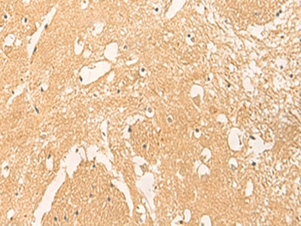 Immunohistochemistry of paraffin-embedded Human brain tissue  using STK32C Polyclonal Antibody at dilution of 1:40(?200)