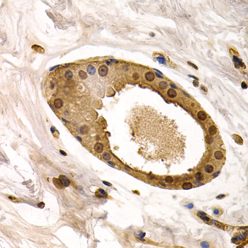 Immunohistochemistry of paraffin-embedded human normal breast using TorsinA/TOR1A Polyclonal Antibody at dilution of 1:200 (40x lens).Perform microwave antigen retrieval with 10 mM PBS buffer pH 7.2 before commencing with IHC staining protocol.