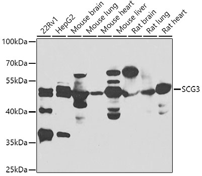 Western blot analysis of extracts of various cell lines using SCG3 Polyclonal Antibody at 1:1000 dilution.