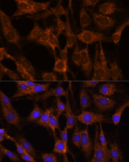 Immunofluorescence analysis of C6 cells using BRPF1 Polyclonal Antibody at dilution of 1:100. Blue: DAPI for nuclear staining.