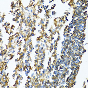 Immunohistochemistry of paraffin-embedded Human lymphonodus using HLA-DPB1 Polyclonal Antibody at dilution of 1:100 (40x lens).