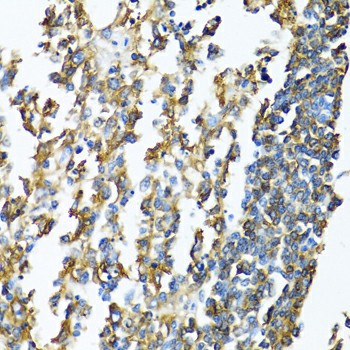 Immunohistochemistry of paraffin-embedded Human lymphonodus using HLA-DPB1 Polyclonal Antibody at dilution of  1:100 (40x lens).