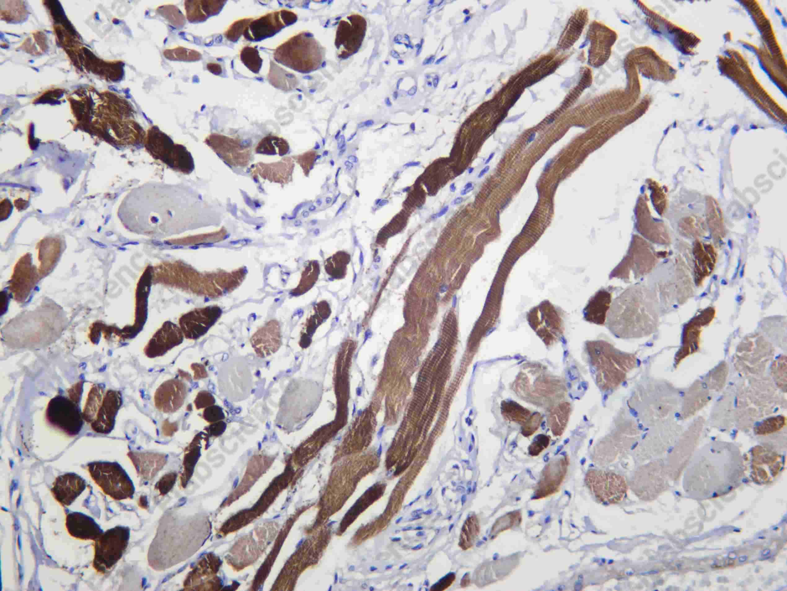 Recombinant Alpha skeletal muscle Actin Monoclonal Antibody - 1