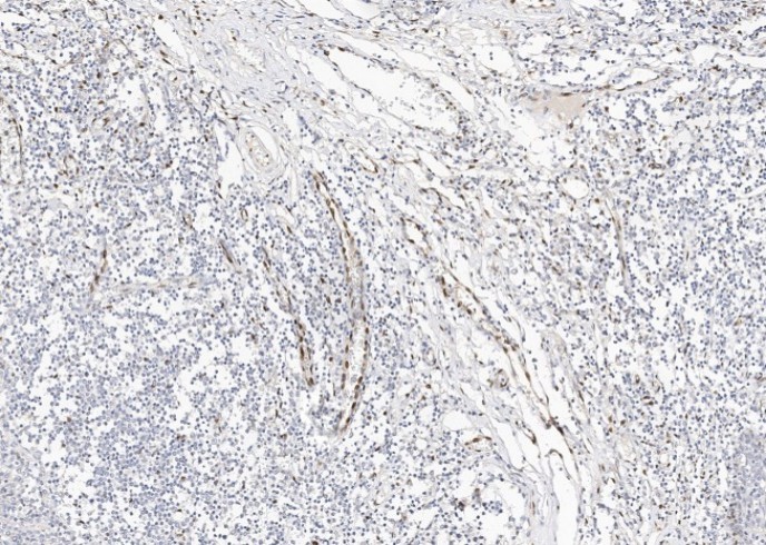 Recombinant IL-33 Monoclonal Antibody - small - 2
