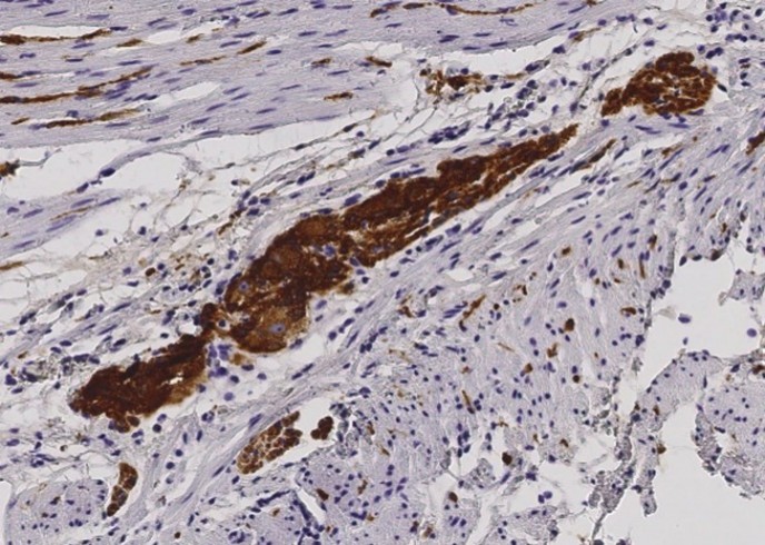 Recombinant CD171/N-CAML1/L1CAM Monoclonal Antibody - small - 3