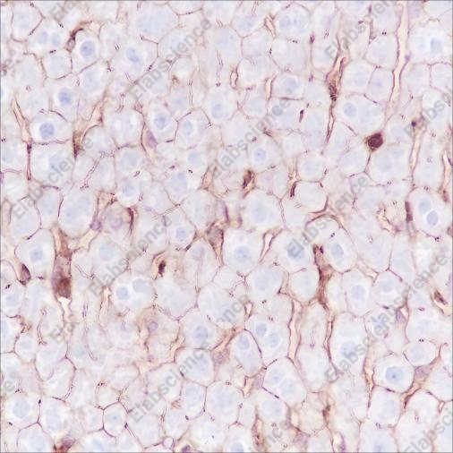 Recombinant Phospho-Girdin (Tyr1765) Monoclonal Antibody - 3