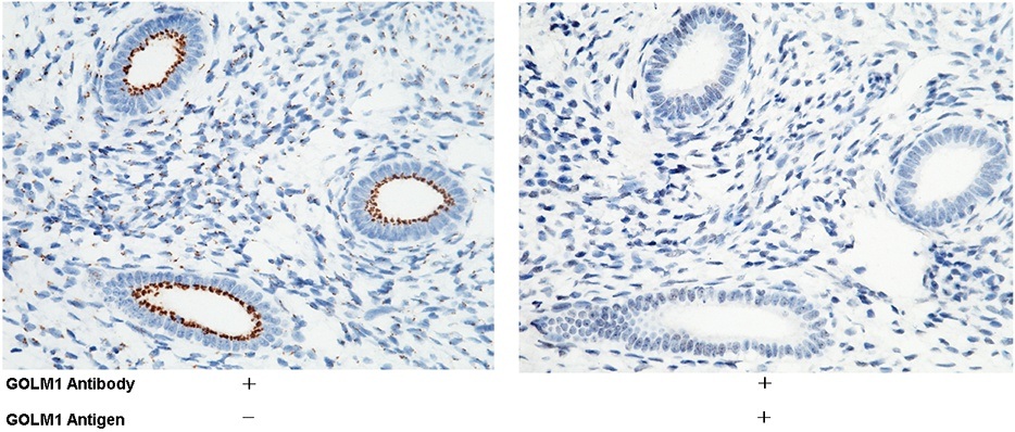 Recombinant GOLM1/GP73 Monoclonal Antibody-searchlist-1