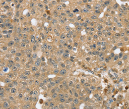 RNH1 Polyclonal Antibody - 2