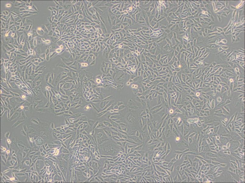 CTLA4 Ig-24 Cell Complete MediumCTLA4 Ig-24 Cell Complete Medium - 2