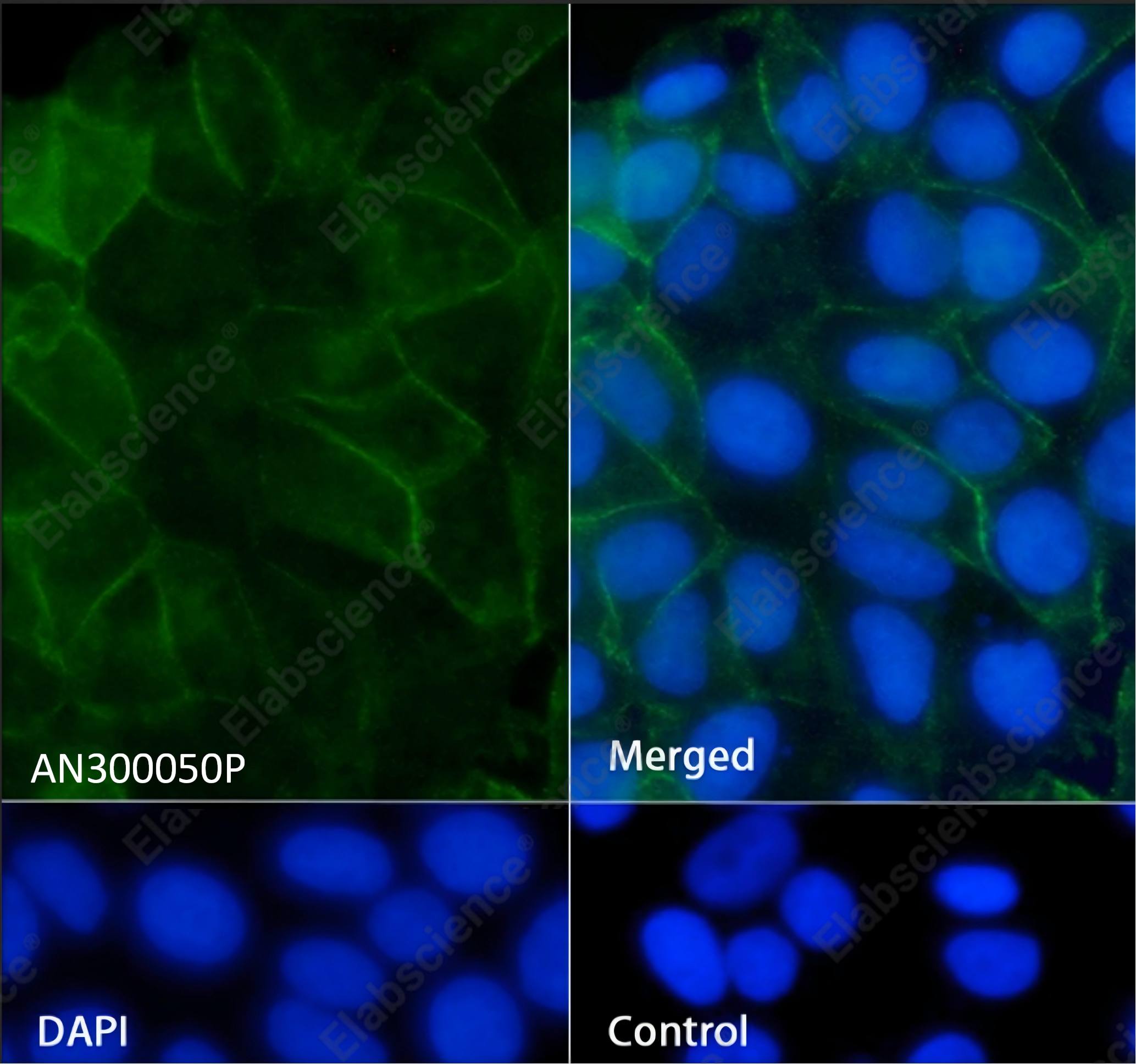 Recombinant IGF1R/CD221 Monoclonal Antibody - 2