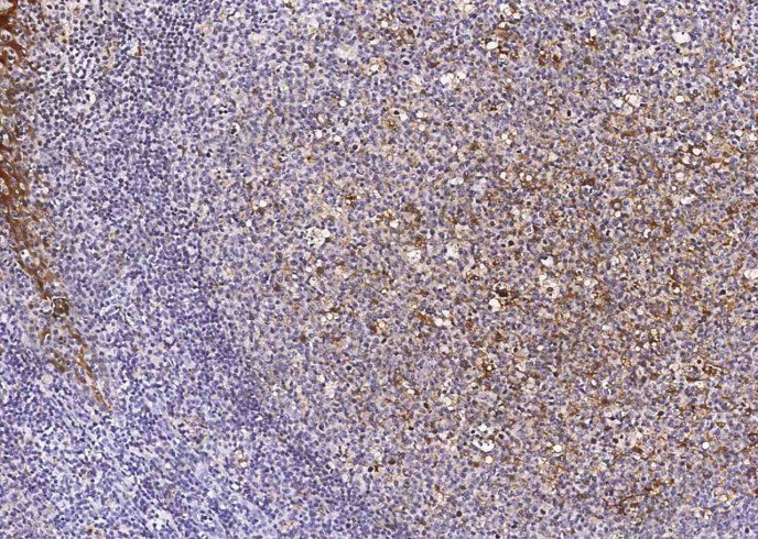 Cystatin A/CSTA Monoclonal Antibody - 1