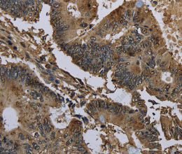 GSTO1 Polyclonal Antibody - 3