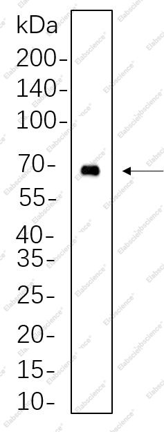 Recombinant BTK Monoclonal Antibody - 1