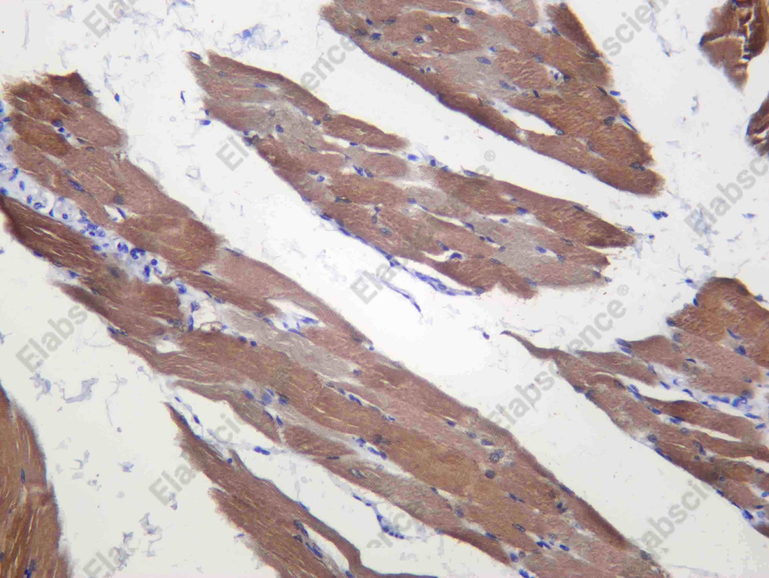 Recombinant PADI2 Monoclonal Antibody - 2