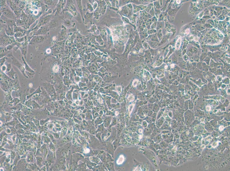 OV-90 Cell Complete Medium - 5