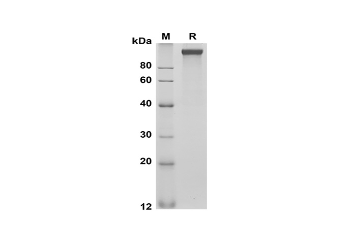 Recombinant Rat IL-21 Protein(Gst Tag)-产品推荐-1