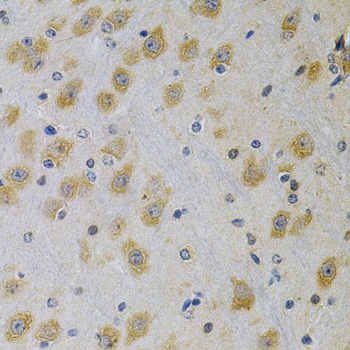 Immunohistochemistry of paraffin-embedded Rat brain using IGFBP4 Polyclonal Antibody at dilution of 1:100 (40x lens).
