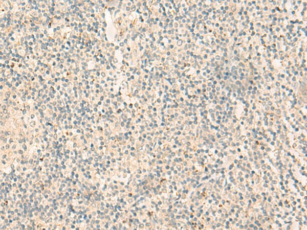 Immunohistochemistry of paraffin-embedded Human tonsil tissue  using NGEF Polyclonal Antibody at dilution of 1:35(?200)