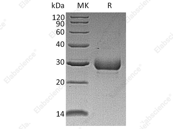 Recombinant Human Noggin/NOG Protein - 1