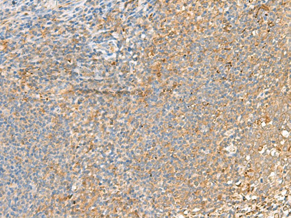 Immunohistochemistry of paraffin-embedded Human tonsil tissue  using GRIK2 Polyclonal Antibody at dilution of 1:55(?200)